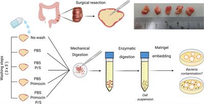 Standardizing Patient-Derived Organoid Generation Workflow to Avoid Microbial Contamination From Colorectal Cancer Tissues